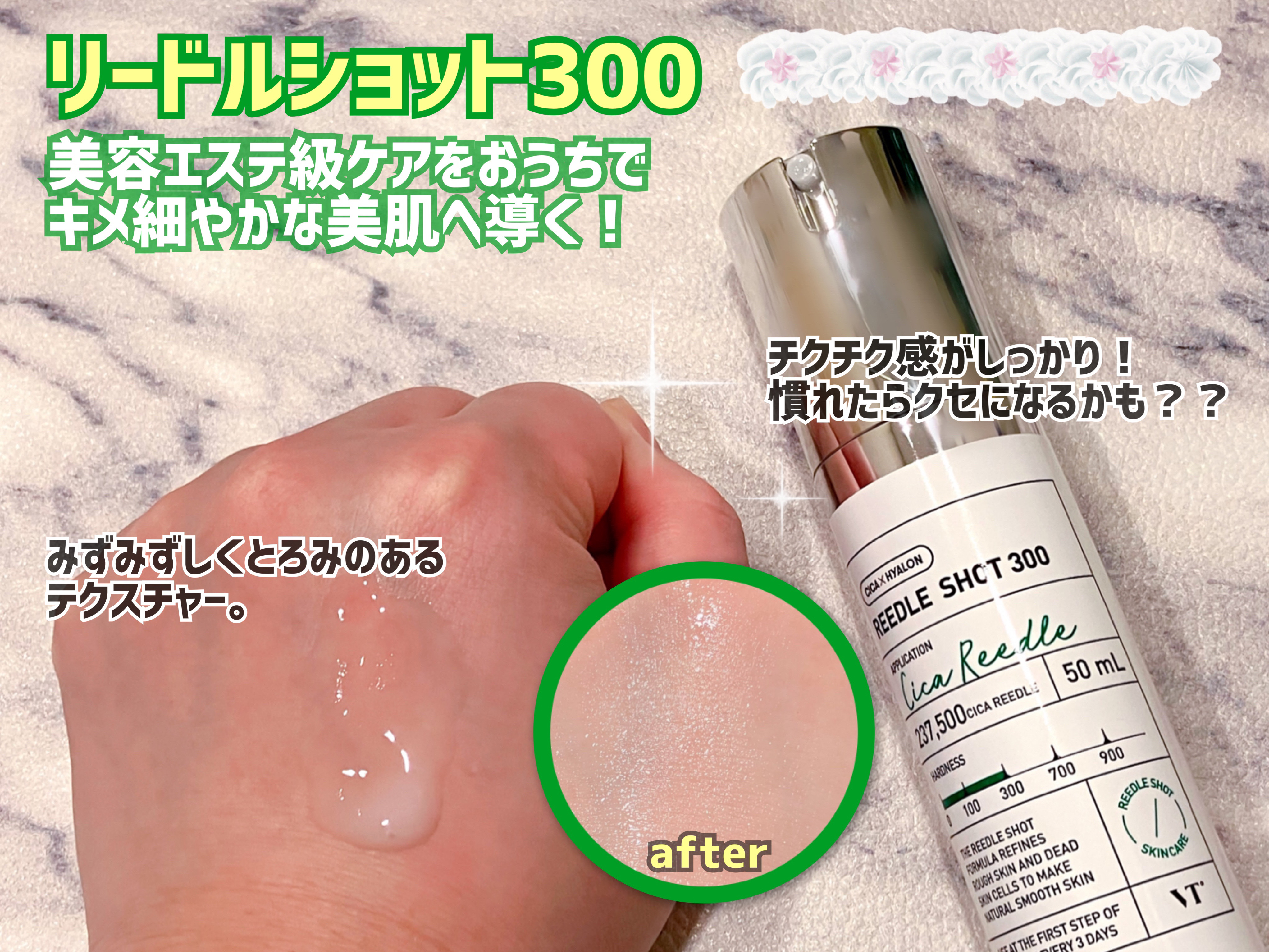 リードルショット300/VT/美容液を使ったクチコミ（2枚目）