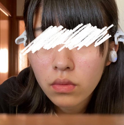 オードムーゲ 薬用ローション(ふきとり化粧水)/オードムーゲ/拭き取り化粧水を使ったクチコミ(2枚目)