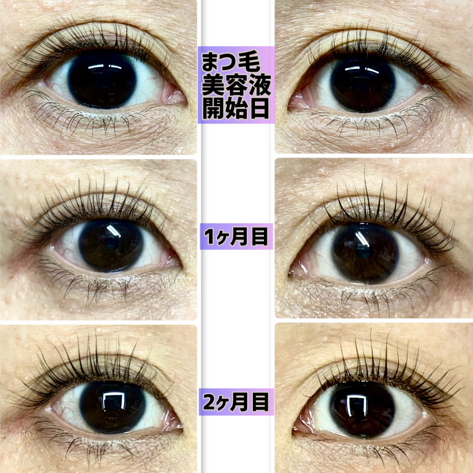 ラッシュアディクト アイラッシュ コンディショニング セラム アドバンス/soaddicted/まつげ美容液を使ったクチコミ（2枚目）