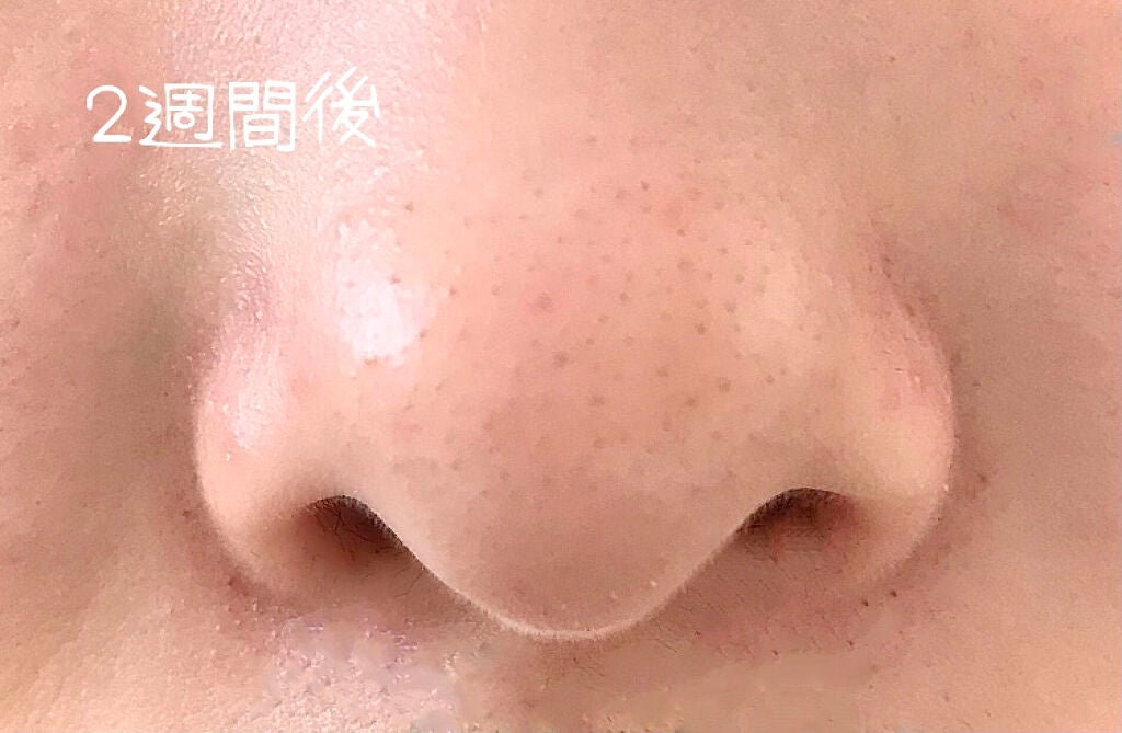 ホホバオイル/無印良品/ボディオイルを使ったクチコミ(3枚目)