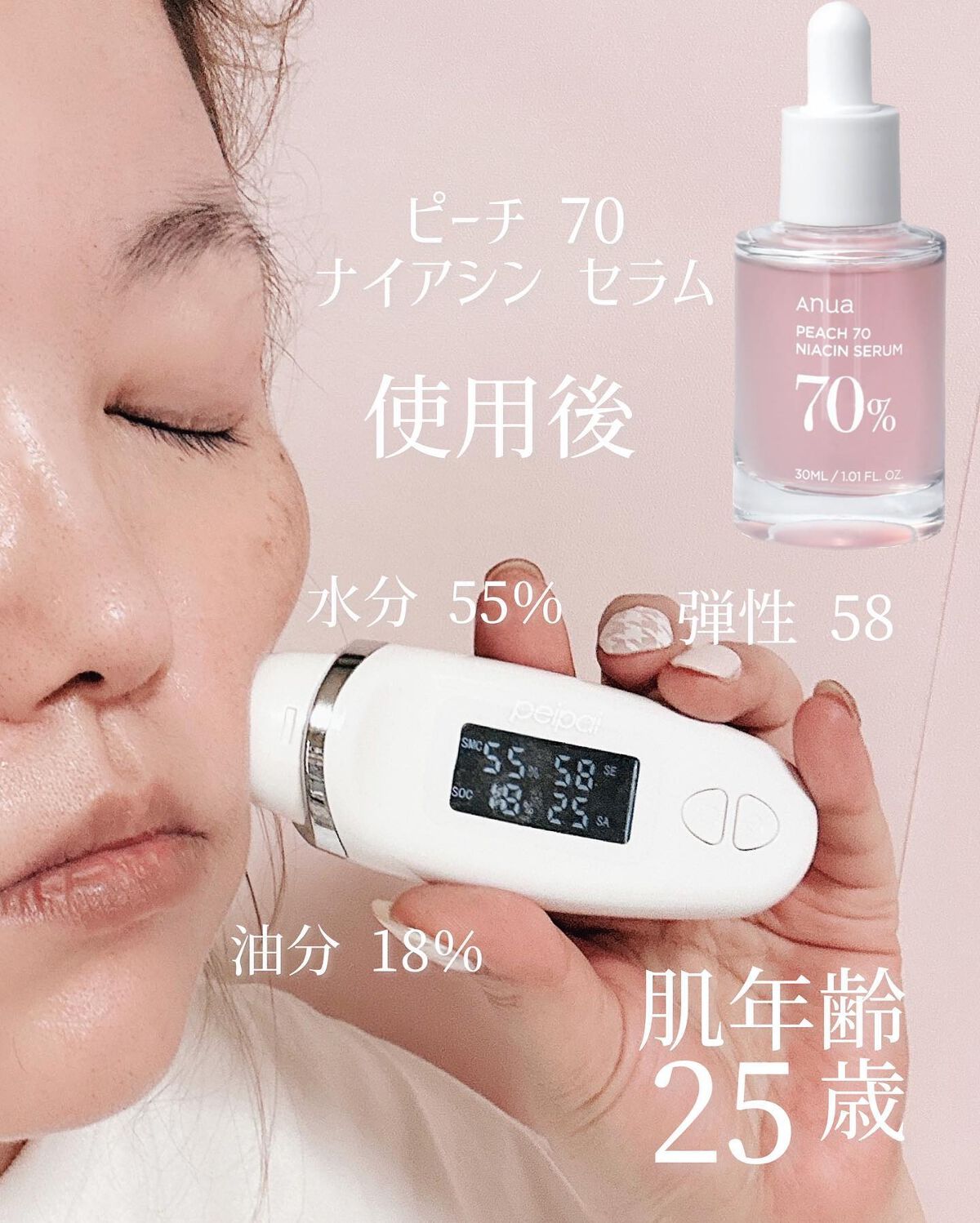 ドクダミ 77 スージングトナー/Anua/化粧水を使ったクチコミ(7枚目)