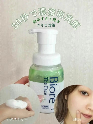 ビオレ ザフェイス 泡洗顔料 アクネケア 本体(200ml)/ビオレ/泡洗顔を使ったクチコミ（1枚目）