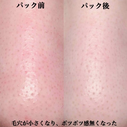 AB/YouTube on LIPS 「バルラボブラッククレイマスク3400円+税(Amazon)かじ..」(4枚目)