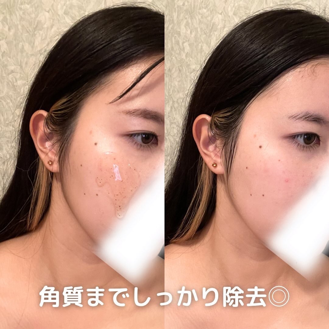 ちゃも on LIPS 「こんにちはちゃもです🐱今回は、ダーマアールエックス™クレンザー..」(4枚目)