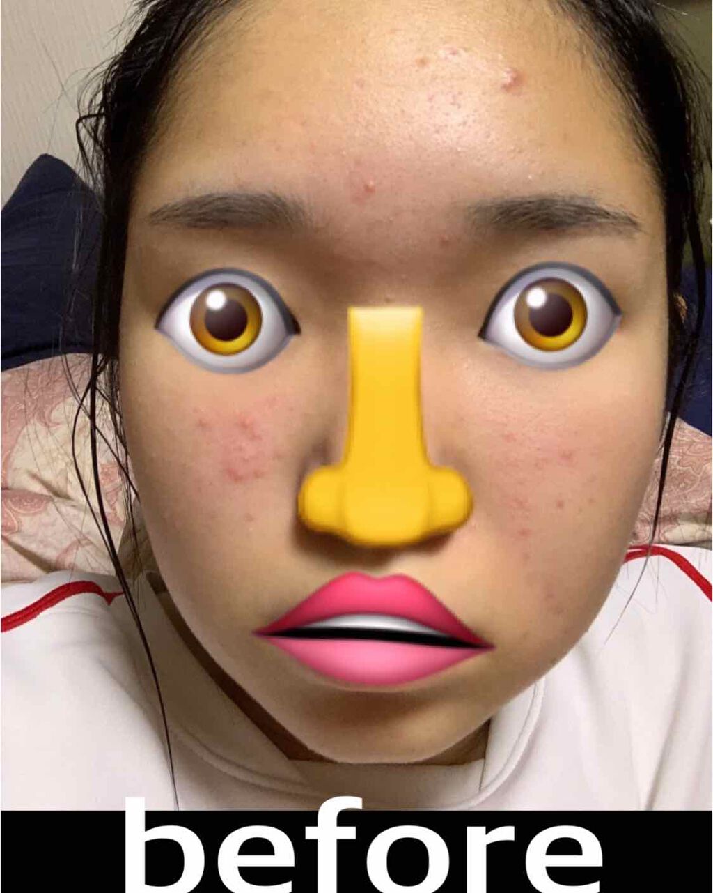 薬用 しみ 集中対策 美容液/メラノCC/美容液を使ったクチコミ（2枚目）