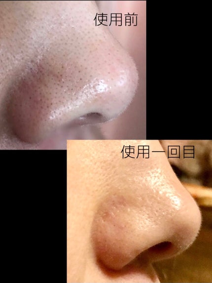 いいじゃんガスール石鹸/イーキューブ/洗顔石鹸を使ったクチコミ(3枚目)