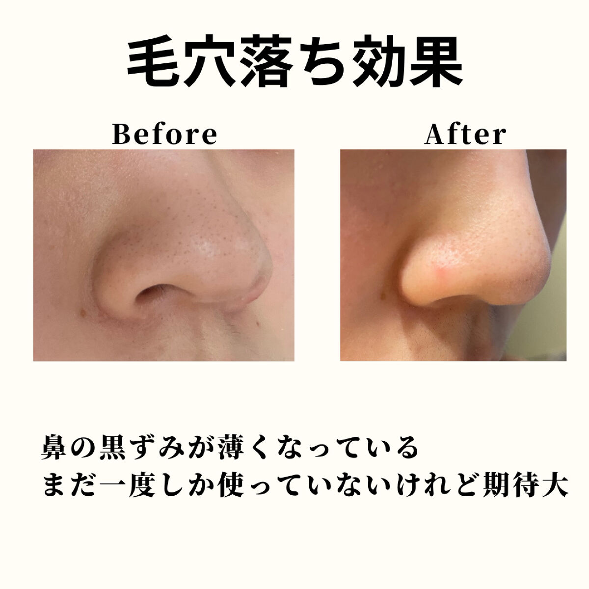 ダヴ 吸着毛穴ケア 洗顔ジェル/ダヴ/その他洗顔料を使ったクチコミ（3枚目）