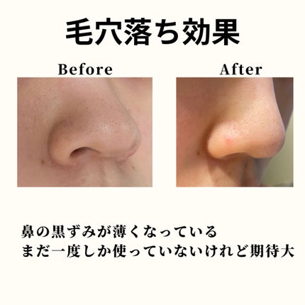 ダヴ 吸着毛穴ケア 洗顔ジェル/ダヴ/その他洗顔料を使ったクチコミ(3枚目)