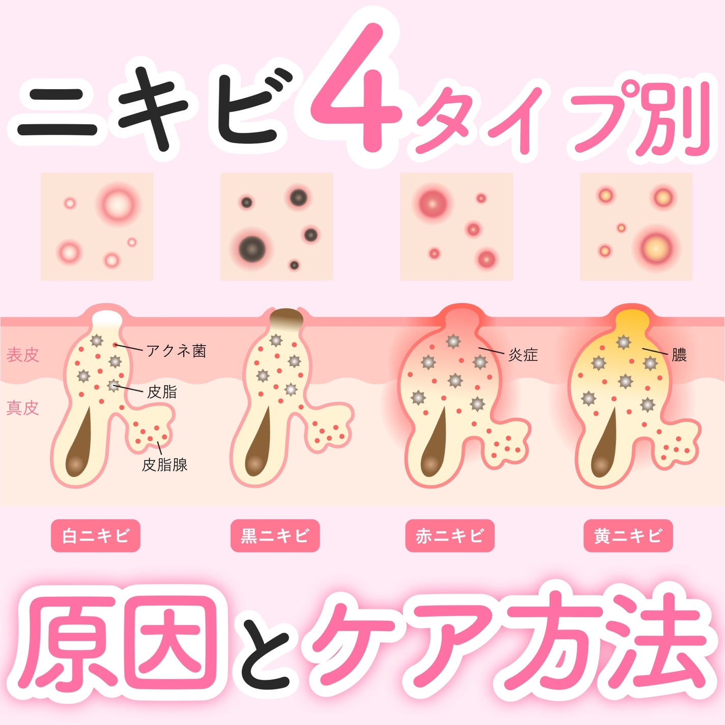 潤浸保湿 フェイスクリーム/キュレル/フェイスクリームを使ったクチコミ(1枚目)