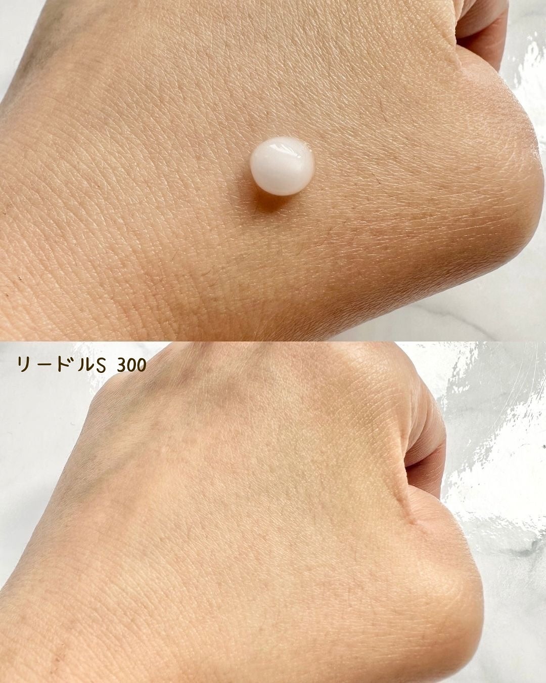 シカレチA エッセンス0.1/VT/美容液を使ったクチコミ(7枚目)