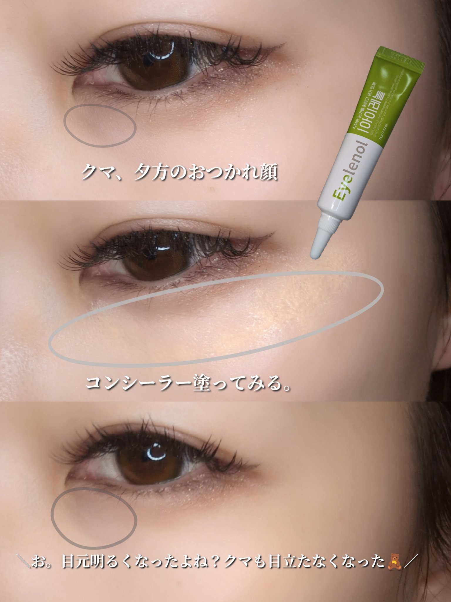 アイレノール クマクリーム/IRENOL/アイケア・アイクリームを使ったクチコミ（1枚目）