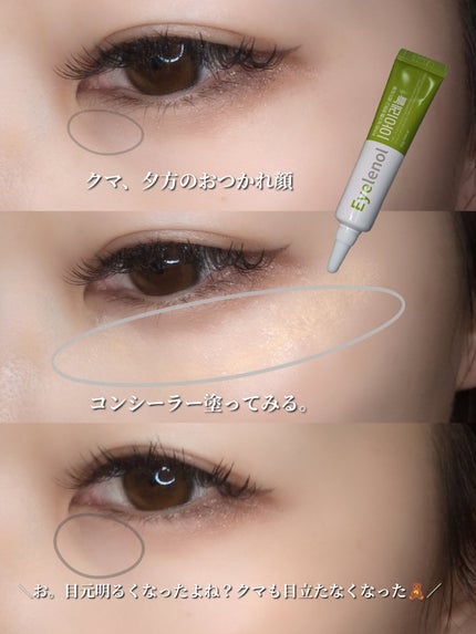 アイレノール クマクリーム/IRENOL/アイケア・アイクリームを使ったクチコミ(1枚目)
