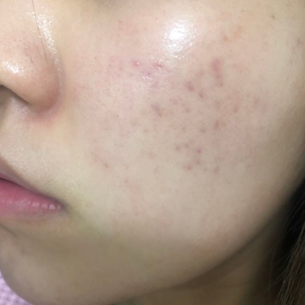 デュオ ザ 薬用クレンジングバーム バリア【医薬部外品】/DUO/クレンジングバームを使ったクチコミ(1枚目)