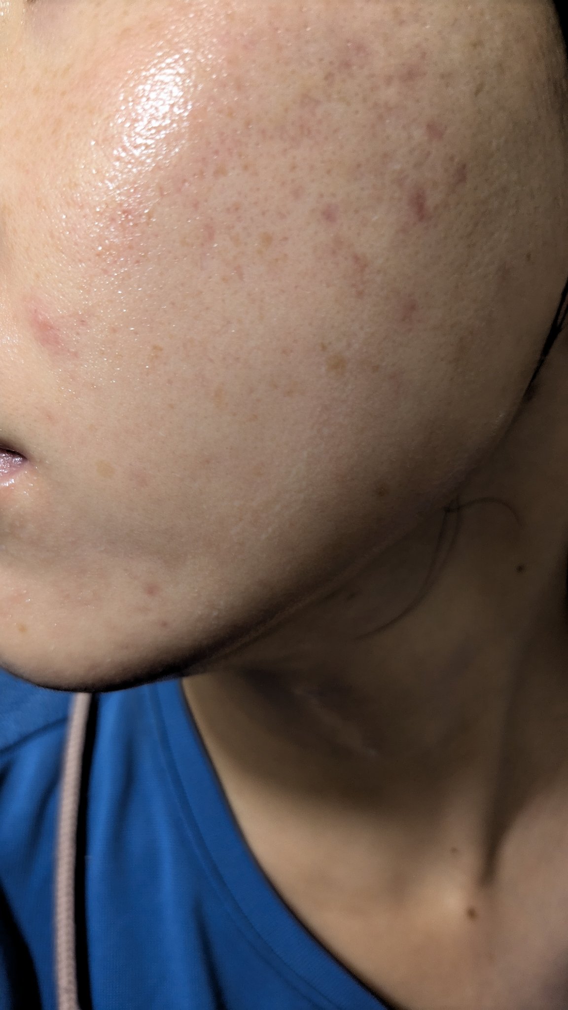 N10+Z1フェイスセラム /The Ordinary/美容液を使ったクチコミ（2枚目）