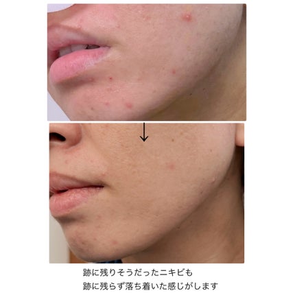 TX-Cream/Dr.Melaxin/フェイスクリームを使ったクチコミ(9枚目)