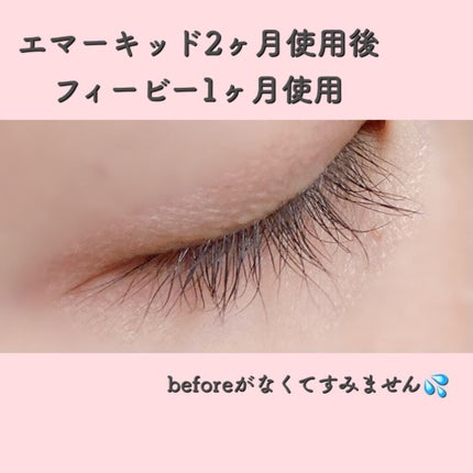 EMAKED(エマーキット)/水橋保寿堂製薬/まつげ美容液を使ったクチコミ(7枚目)