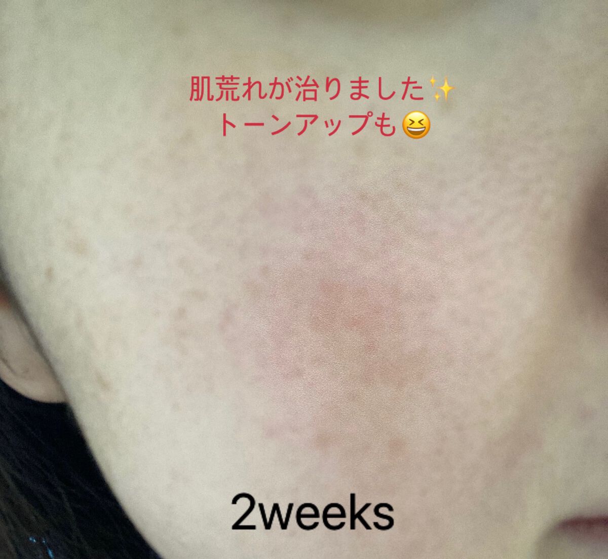 バイオ コンディショニング エッセンス/IOPE/ブースター・導入液を使ったクチコミ(6枚目)