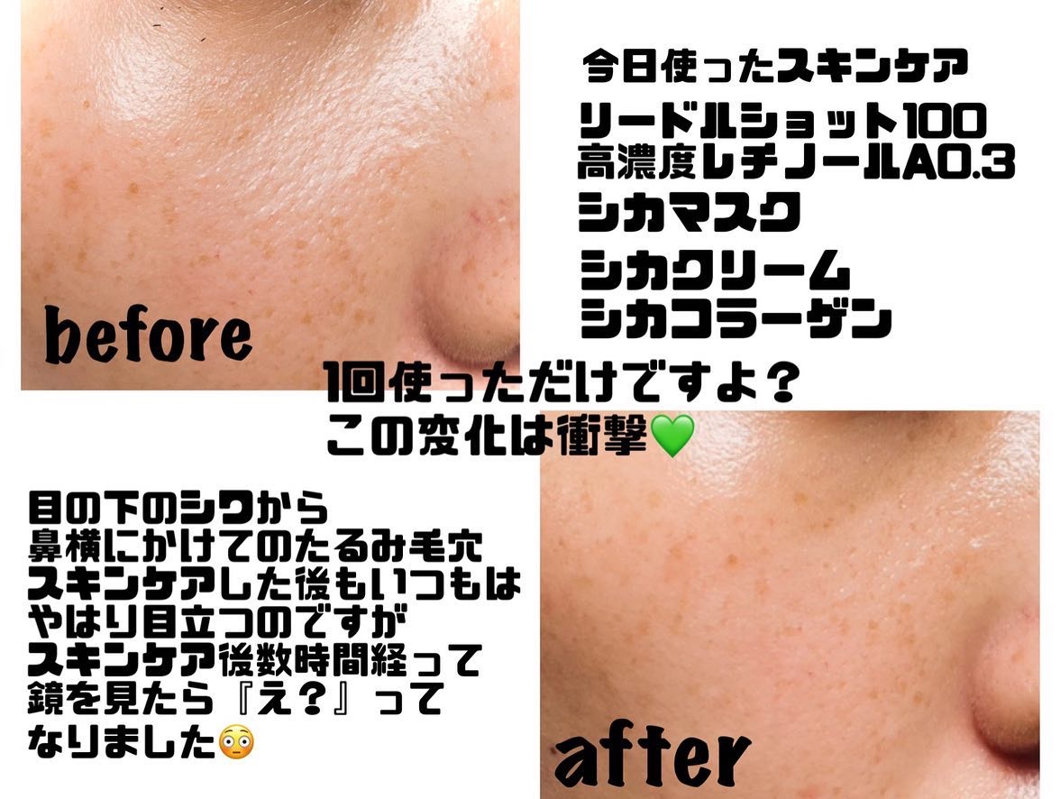 CICA クリーム/VT/フェイスクリームを使ったクチコミ（2枚目）