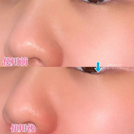 ノーモアブラックヘッド(ノーズピーリング)/One-day's you/スクラブ・ゴマージュを使ったクチコミ(5枚目)