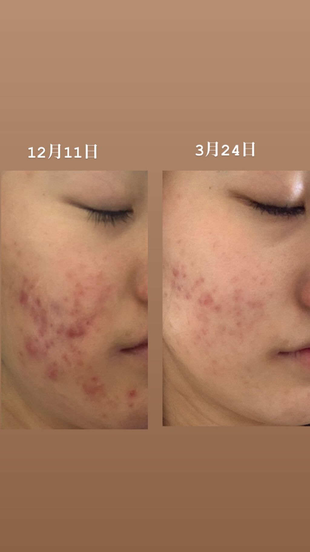 バランスアップ ローション(III)/アクアレーベル/化粧水を使ったクチコミ（1枚目）