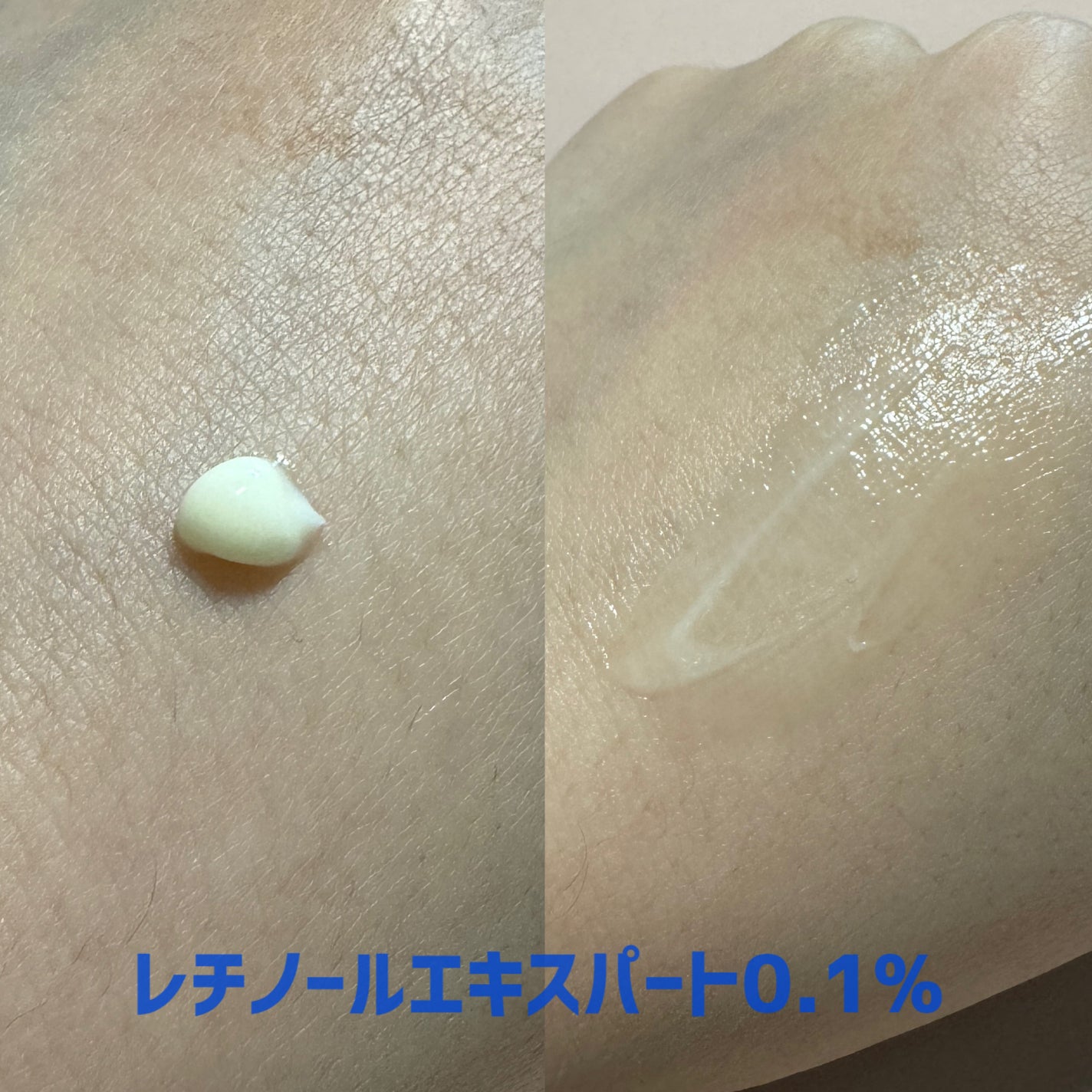 レチノール エキスパート0.1%/IOPE/美容液を使ったクチコミ(3枚目)