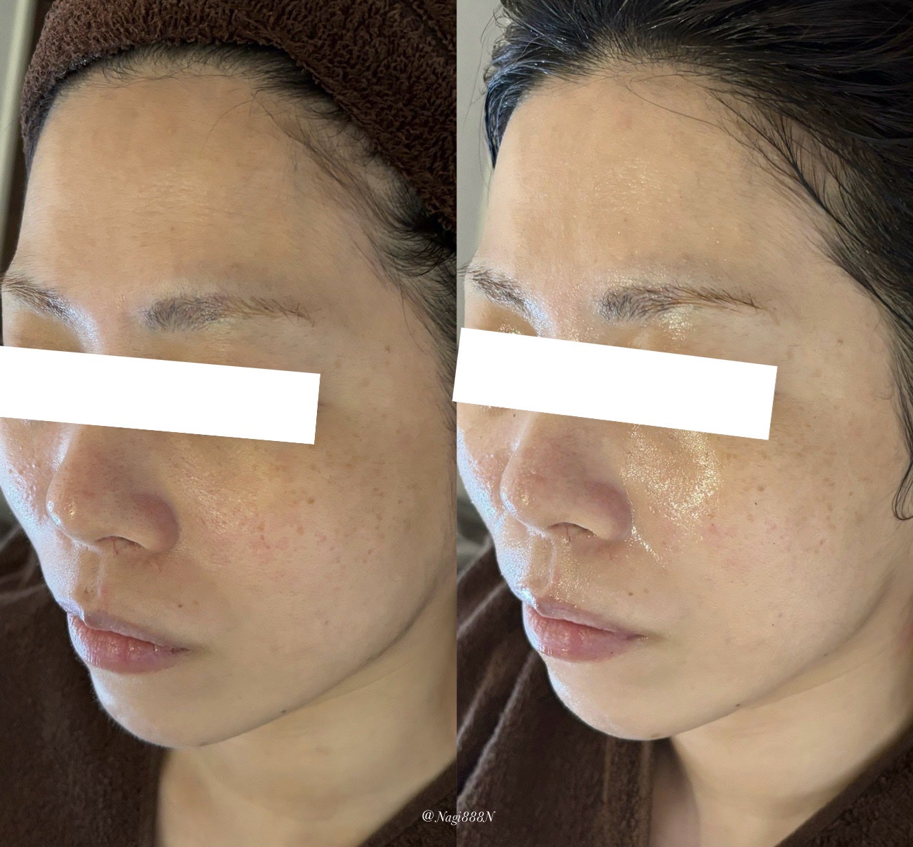 Nagi フォロバ100☺︎ on LIPS 「東新宿の肌改善サロンBeautySalonClaireさんでフ..」(4枚目)