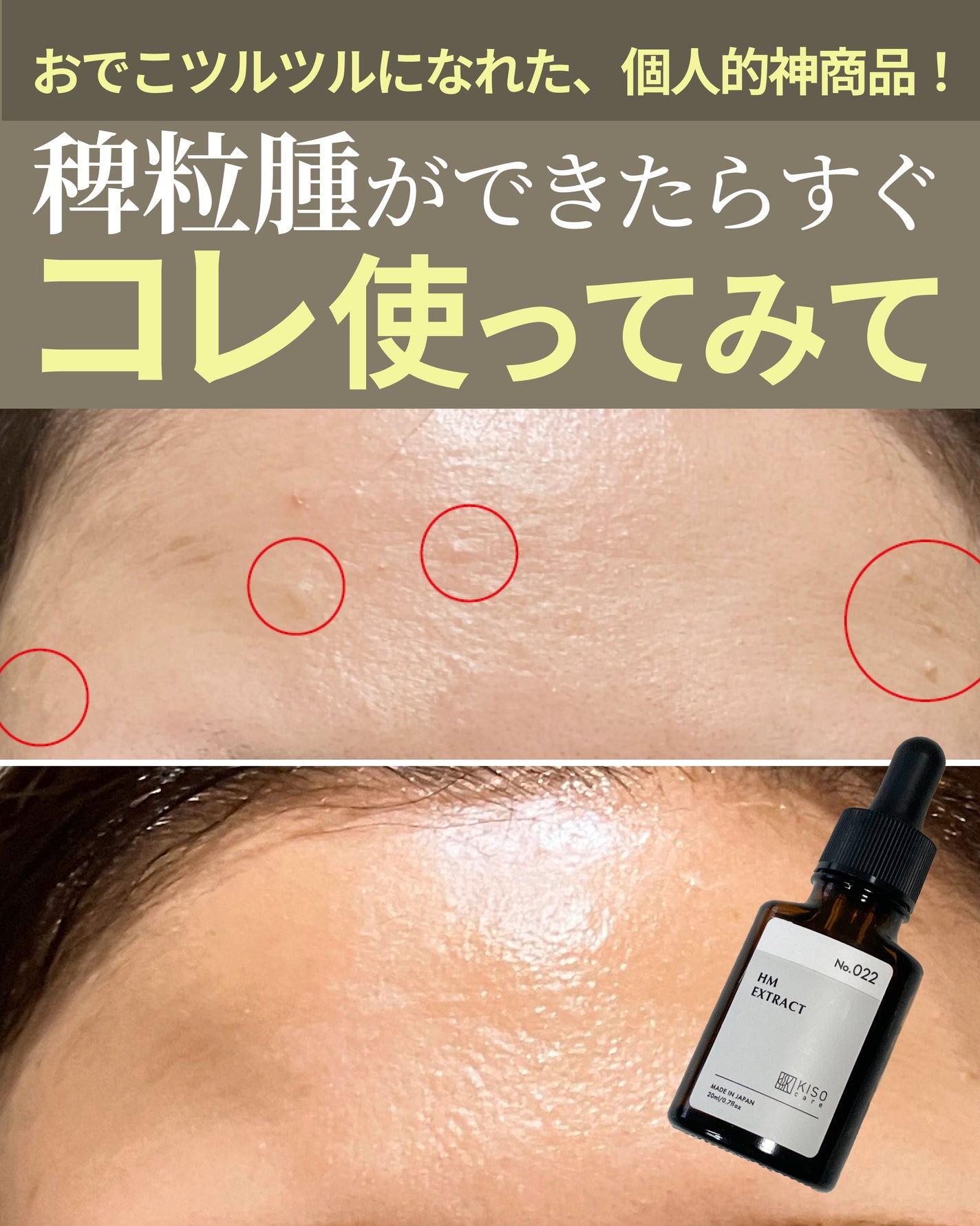 オーガニック ハトムギエキス (ヨクイニン)/KISO/その他を使ったクチコミ(1枚目)