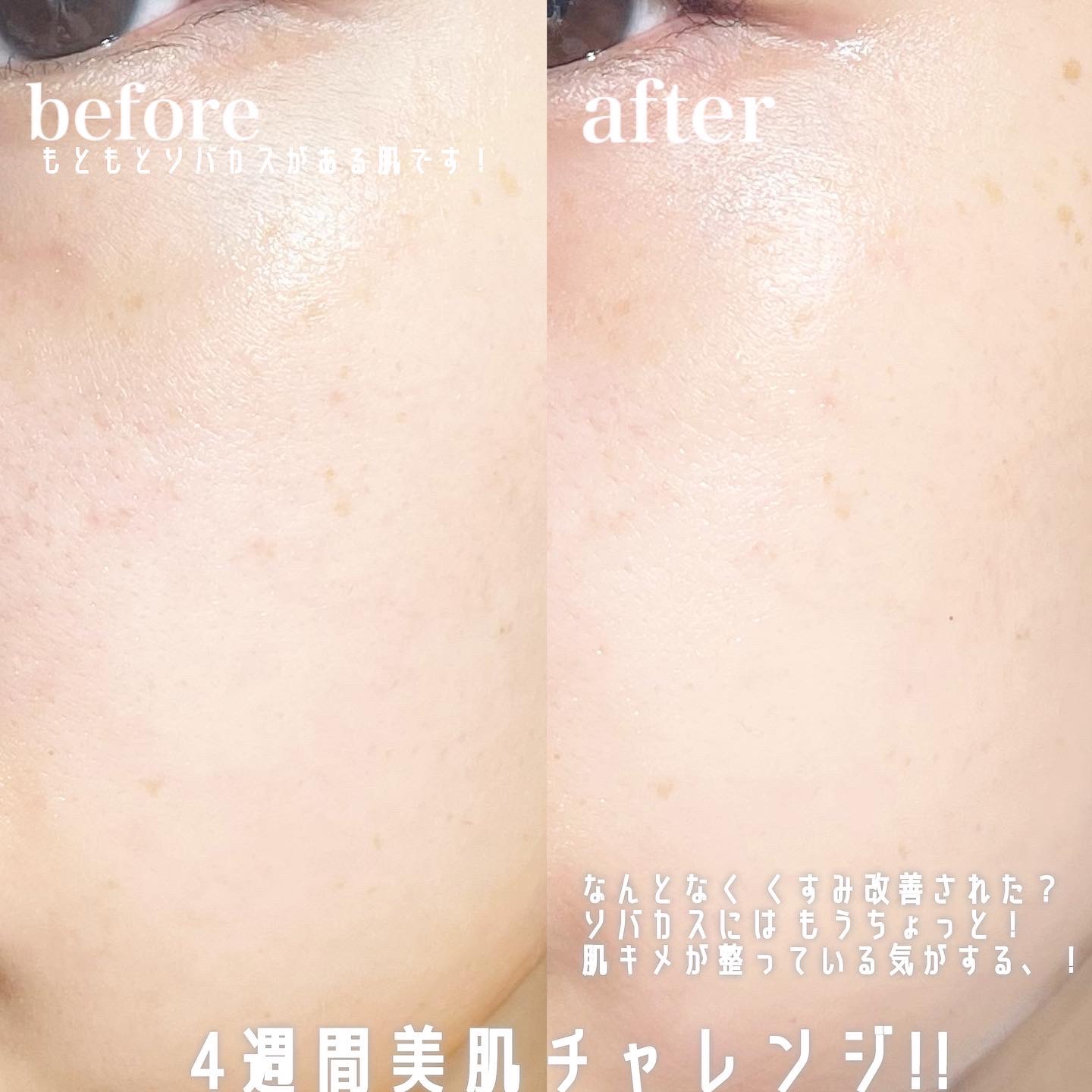 ビタペアC ビタレチ美容液/ネイチャーリパブリック/美容液を使ったクチコミ（3枚目）