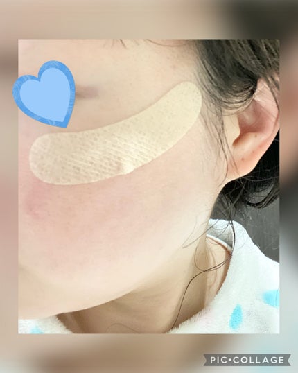 はっぱ*フォロバ100 on LIPS 「【フェイシャルテープ】目の下ヒッパロンメイク感覚で、なりたい顔..」(5枚目)