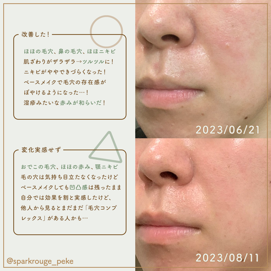 潤浸保湿 化粧水 III とてもしっとり/キュレル/化粧水を使ったクチコミ(4枚目)