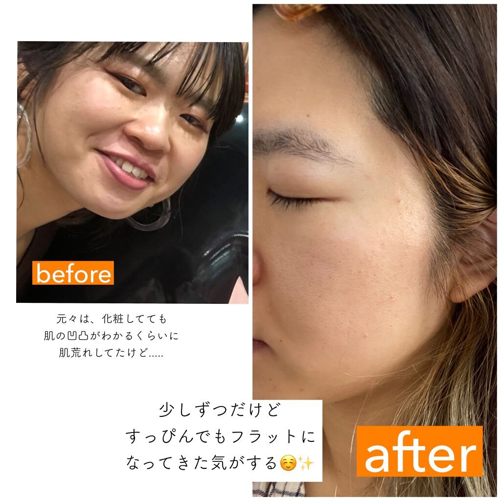 shiho. on LIPS 「.17skin-イチナナスキン-高濃度ビタミンC-------..」(2枚目)