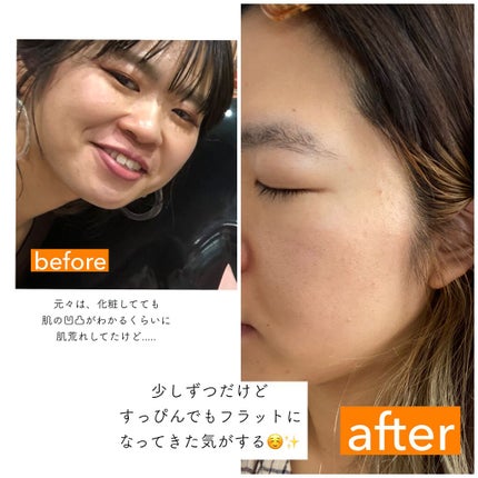 を使ったクチコミ(2枚目)