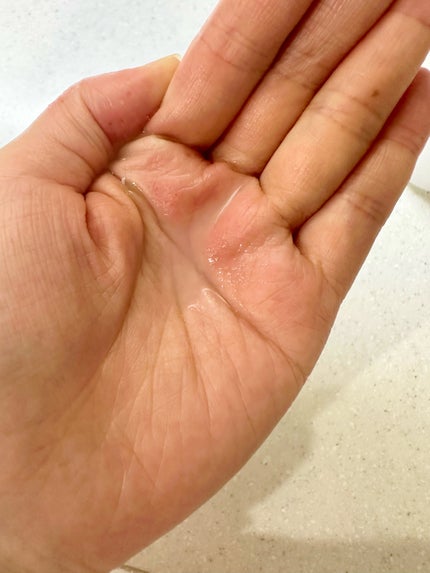 ハトムギ化粧水(ナチュリエ スキンコンディショナー R )/ナチュリエ/化粧水を使ったクチコミ(2枚目)