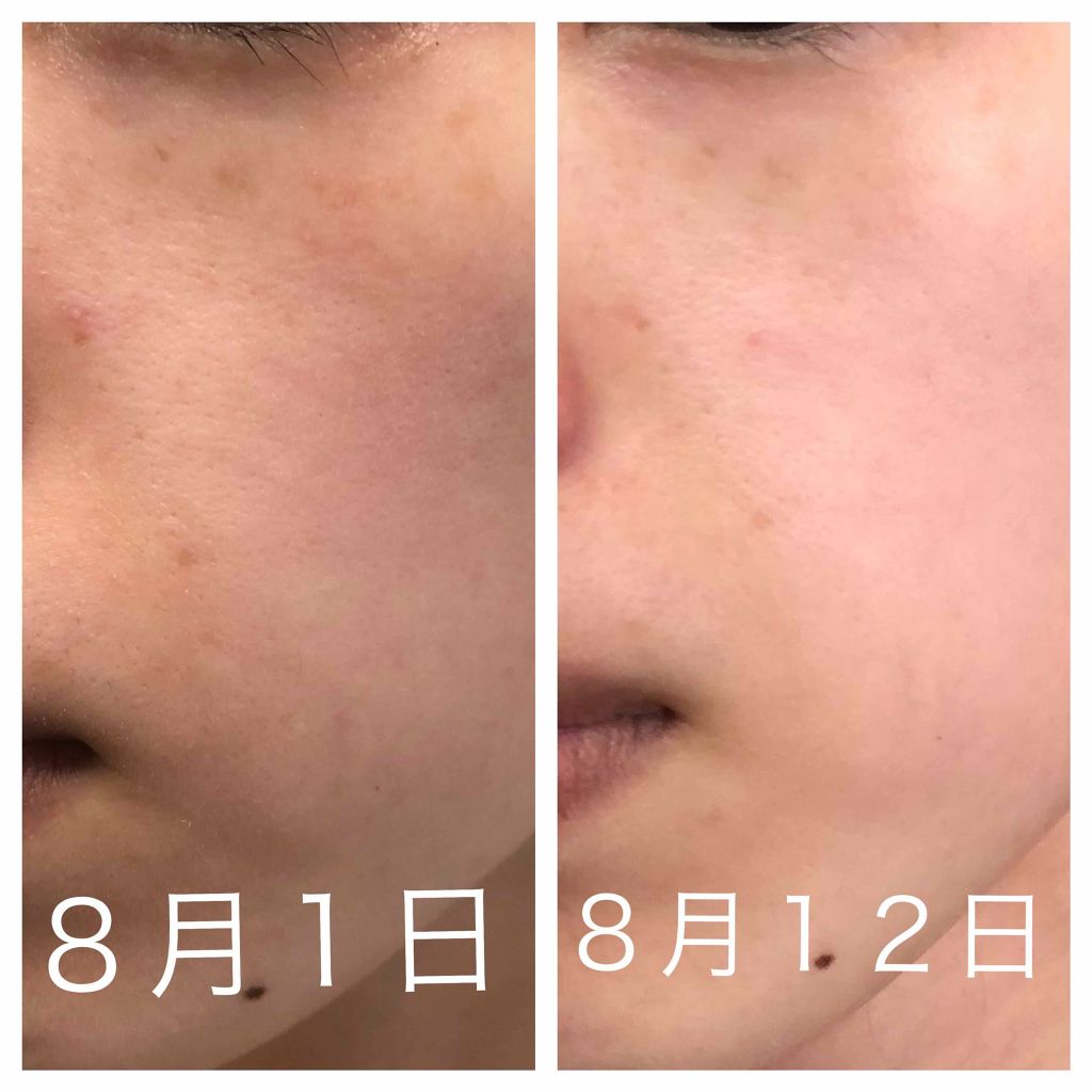 DHC はとむぎエキス/DHC/健康サプリメントを使ったクチコミ(3枚目)