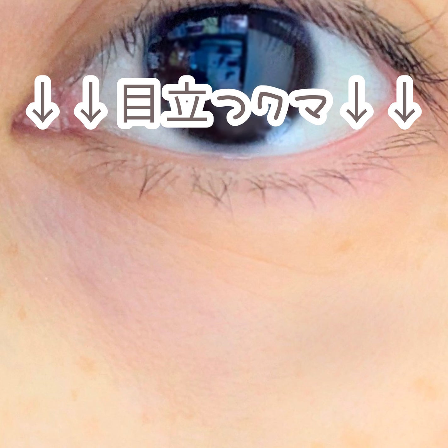 アイレノール クマクリーム/IRENOL/アイケア・アイクリームを使ったクチコミ(3枚目)