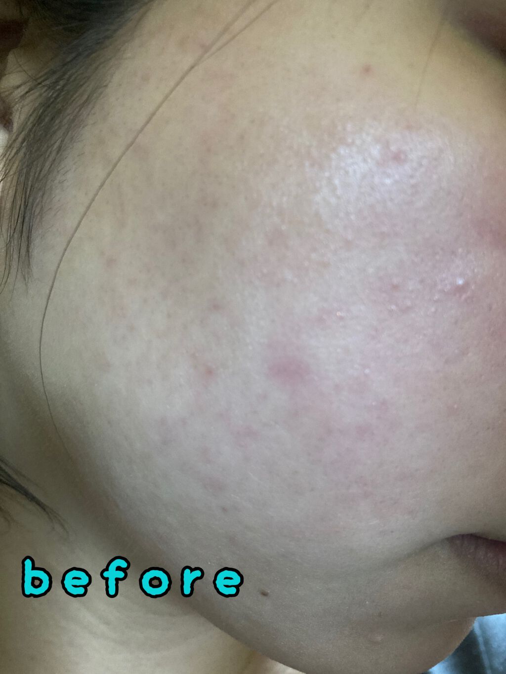 フィットミー リキッドファンデーション R/MAYBELLINE NEW YORK/リキッドファンデーションを使ったクチコミ(2枚目)