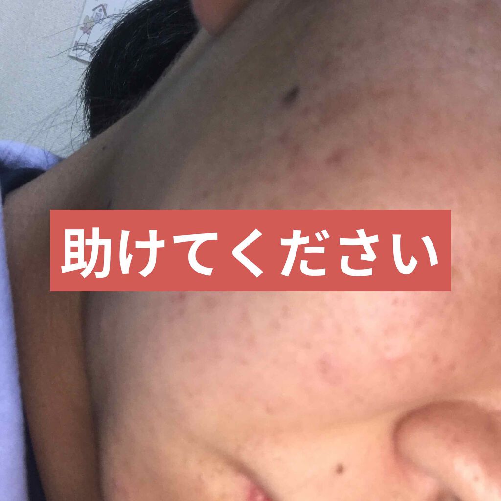 ハトムギ化粧水(ナチュリエ スキンコンディショナー R )/ナチュリエ/化粧水を使ったクチコミ（1枚目）