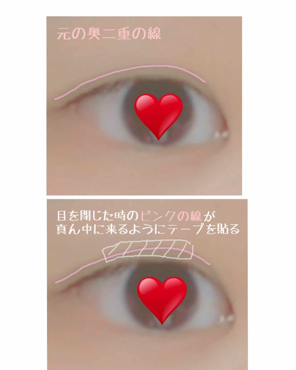 のびーるアイテープ（絆創膏タイプ、レギュラー）/DAISO/二重まぶた用アイテムを使ったクチコミ（2枚目）