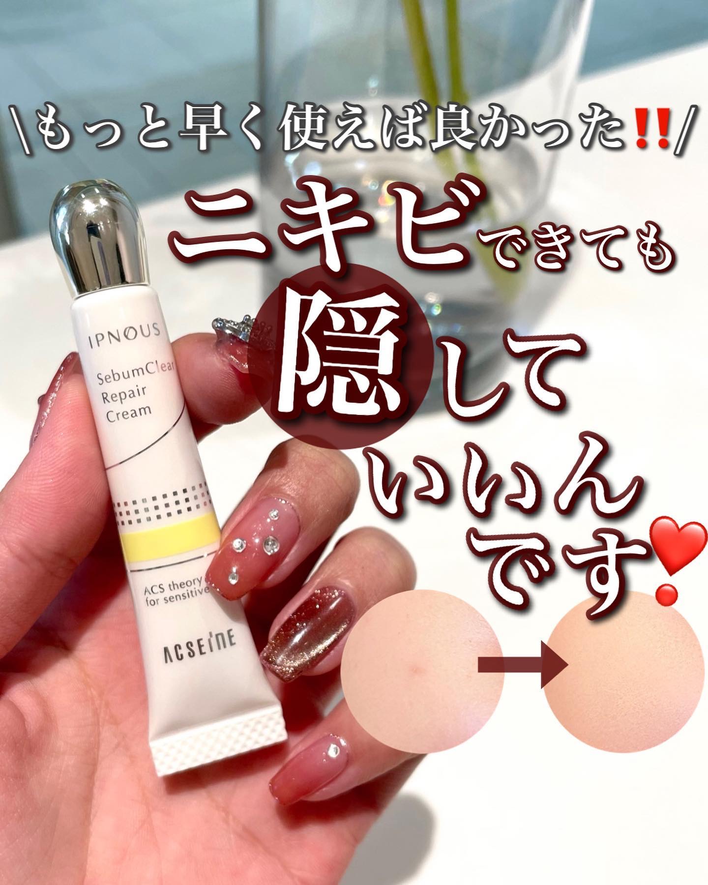 イプノス シーバムクリア リペアクリーム/ACSEINE/フェイスクリームを使ったクチコミ（1枚目）