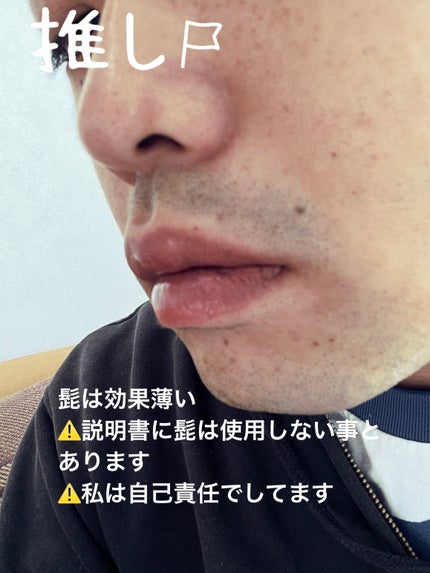 スムーズスキン pure fit/スムーズスキン/家庭用脱毛器を使ったクチコミ(3枚目)