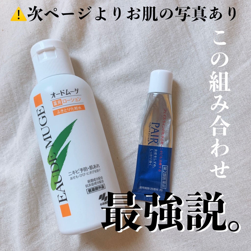 オードムーゲ 薬用ローション(ふきとり化粧水)/オードムーゲ/拭き取り化粧水を使ったクチコミ(1枚目)