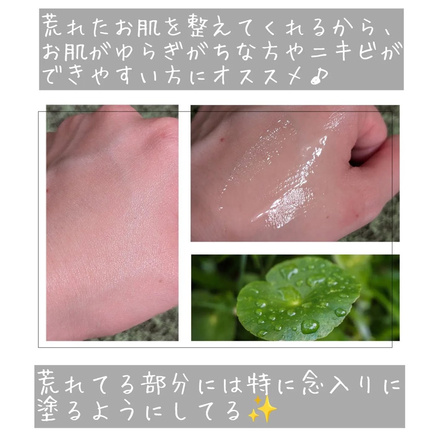 ノスカナイン トラブル セラム/FATION/美容液を使ったクチコミ(5枚目)