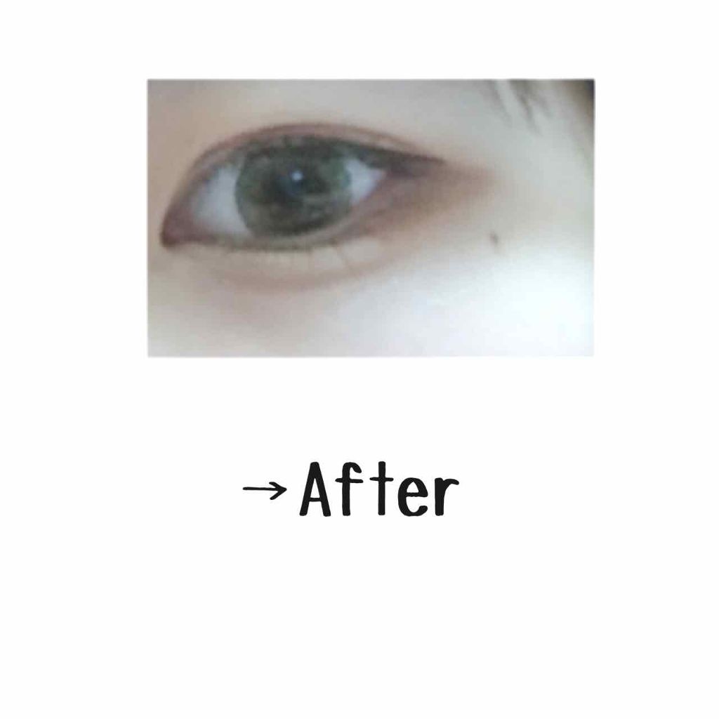 ひとえ・奥ぶたえ用カーラー/アイプチ®/ビューラーを使ったクチコミ（2枚目）