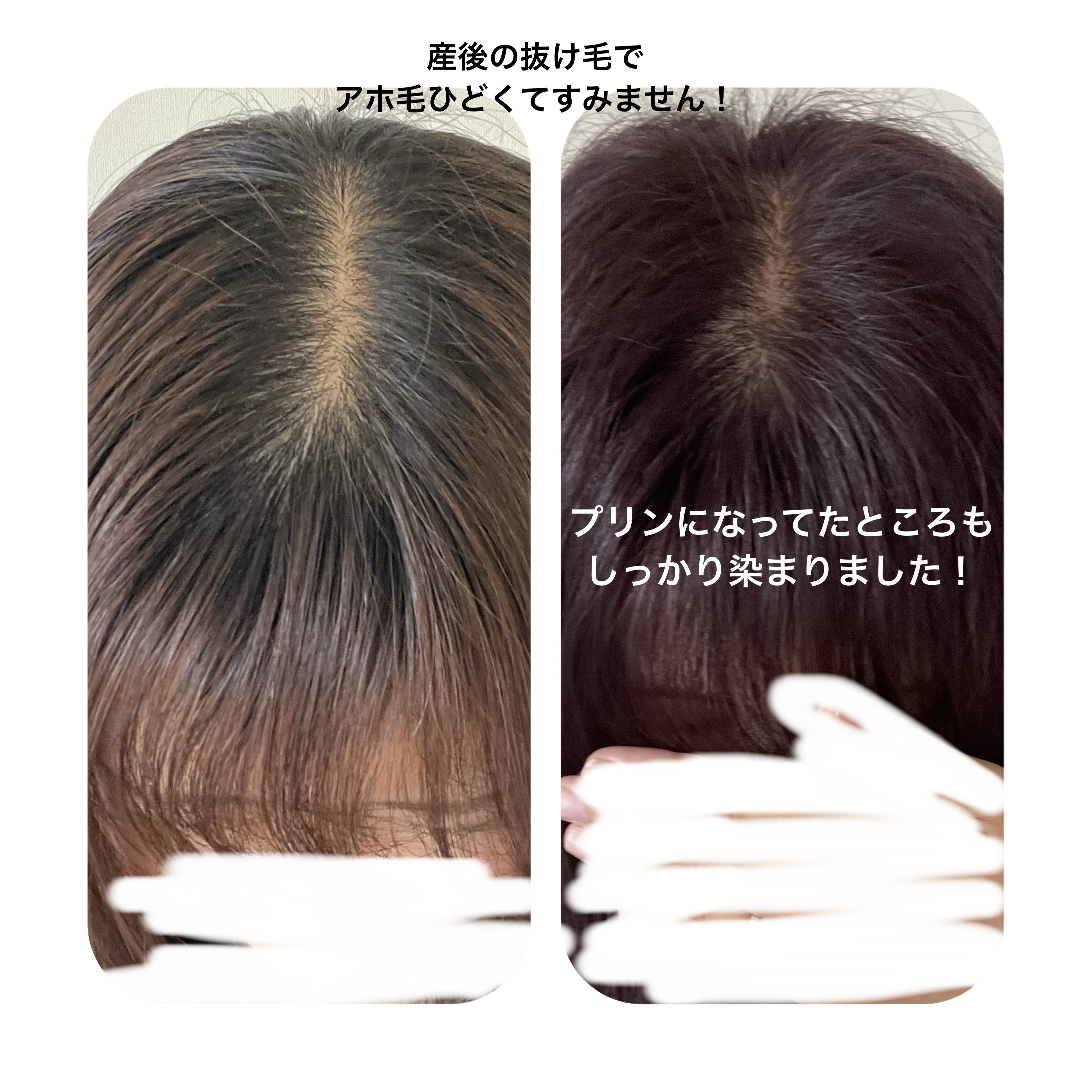 泡カラー/リーゼ/ヘアカラーを使ったクチコミ（3枚目）