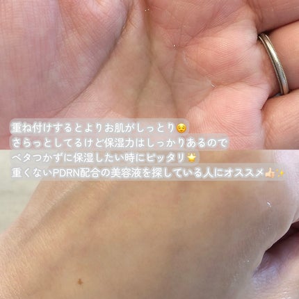 PDRNヒアルロン酸カプセル100セラム/Anua/美容液を使ったクチコミ(3枚目)