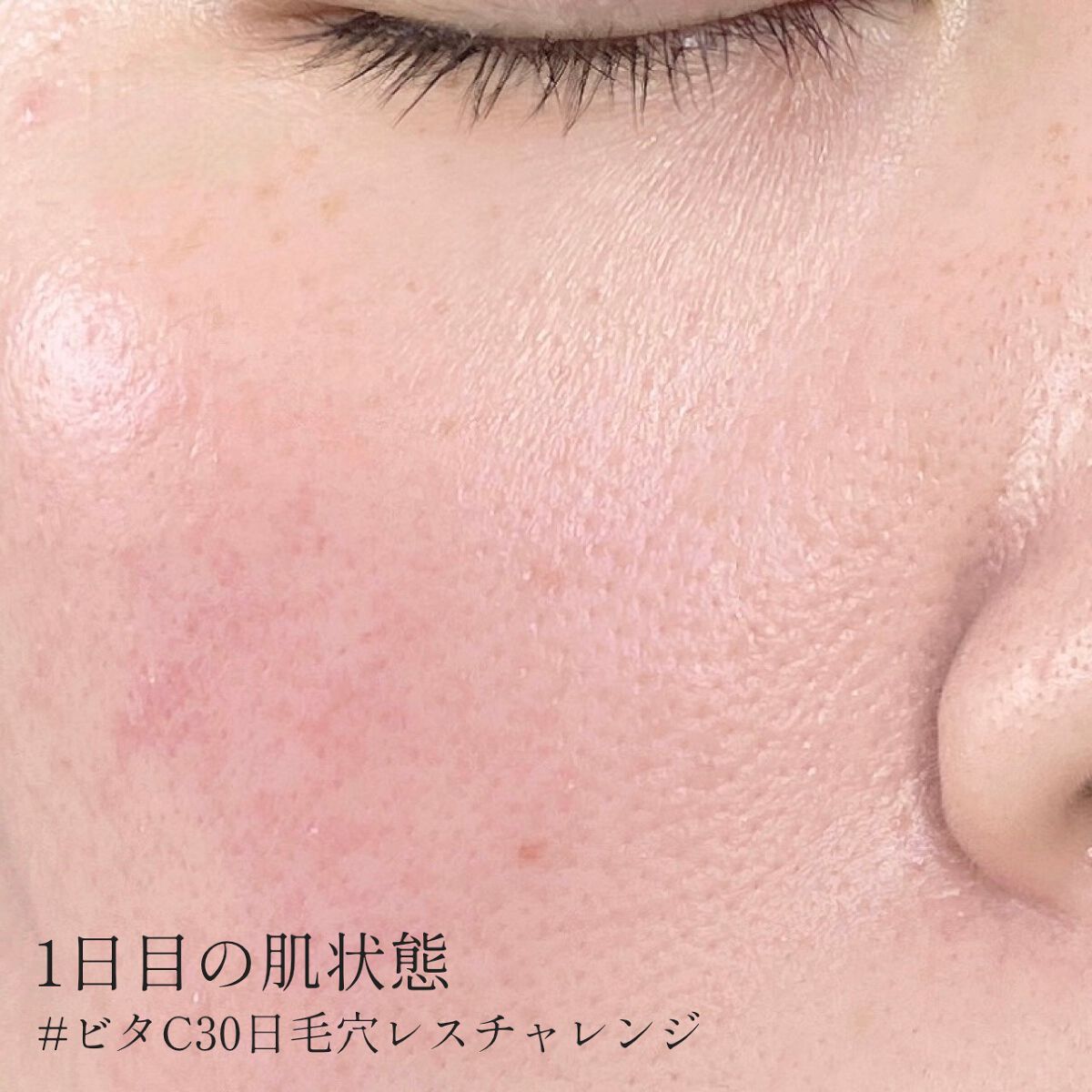 ミシャ ビタシープラス デイリーマスク【日本処方】/MISSHA/シートマスク・パックを使ったクチコミ（3枚目）