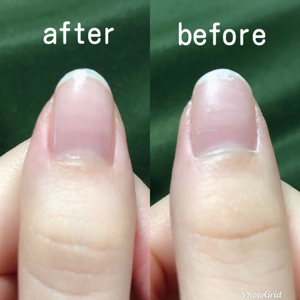 ディーアップファンデーション/D-UP/ネイルベースコートを使ったクチコミ（2枚目）