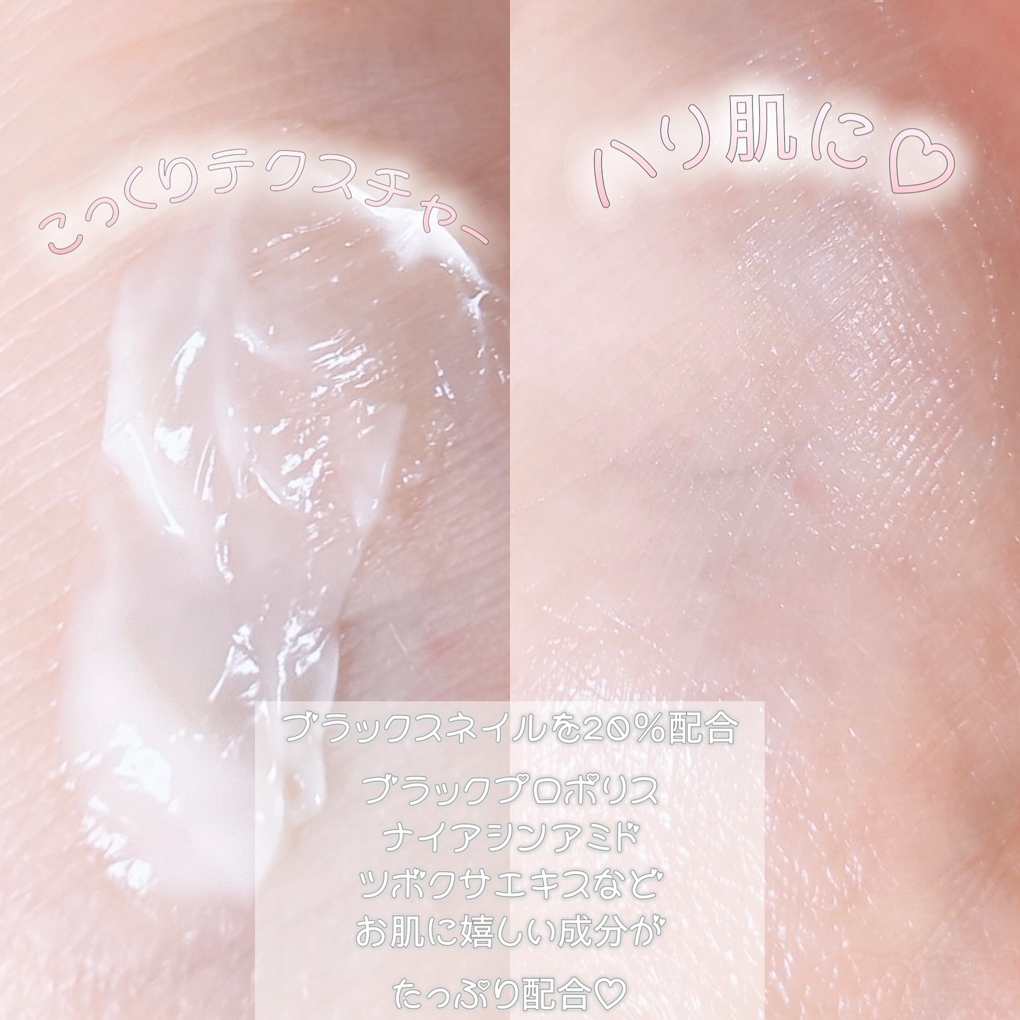 ブラックスネイル クリーム/Dr.G/フェイスクリームを使ったクチコミ（3枚目）