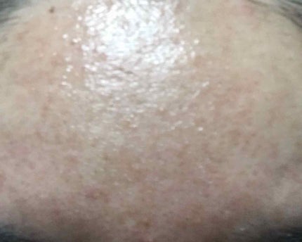 エテュセ リップエッセンス/ettusais/リップ美容液を使ったクチコミ(2枚目)