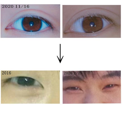 アイトーク/アイトーク/二重まぶた用アイテムを使ったクチコミ(2枚目)